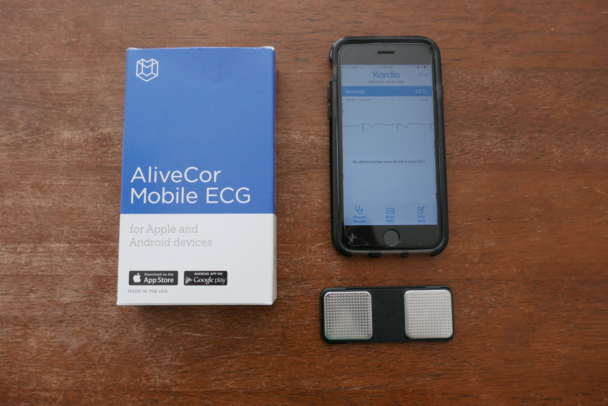 AliveCor Review for People with Heart Palpitations